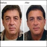Jeunesse+Global+Europa+testimonial