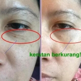 Jeunesse-Wrinkle+gone