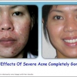 Jn Indonesia testimonials3