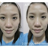 Montagne-Jeunesse-Pore-Cleansing-Fruit-Smoothie-Mask-Before-and-After
