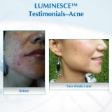 Websit contents-Luminesce testimonials4