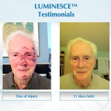 Website contents-Luminesce testimonials