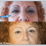 before-after9-12