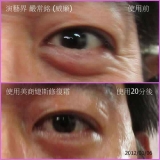 jeunesse-kerut-mata-laki2